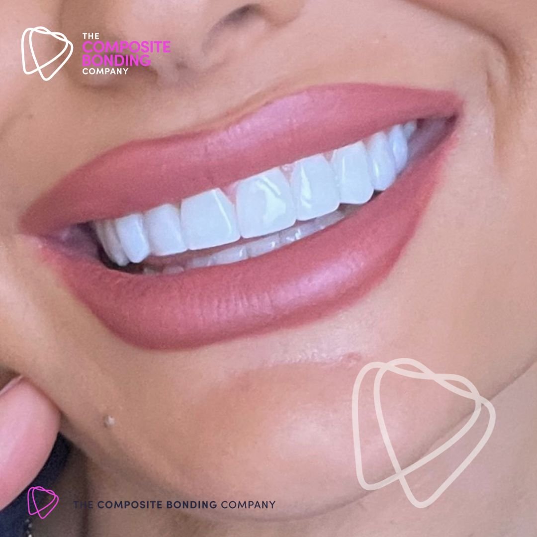 CBC Posts designs (Do not delete) (4)