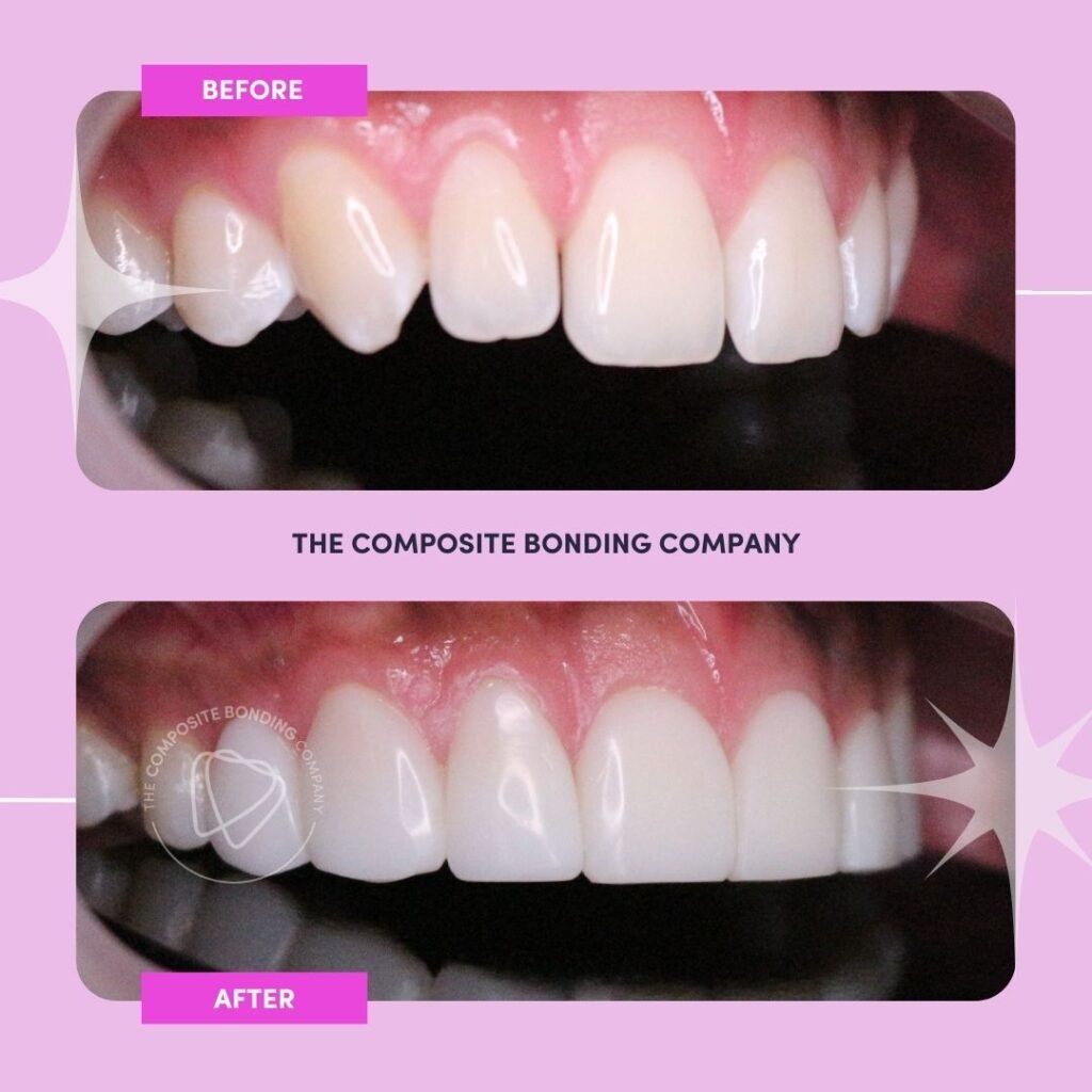 The Composite Bonding Company B&A