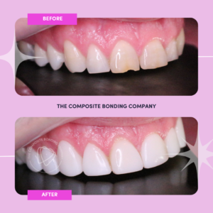 I B&A