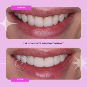 J1 B&A