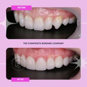 J2 B&A