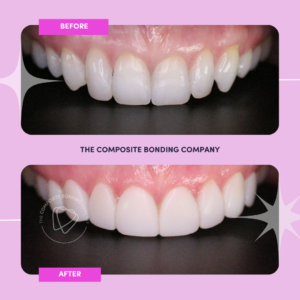 J3 B&A
