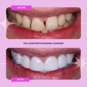 K1 B&A