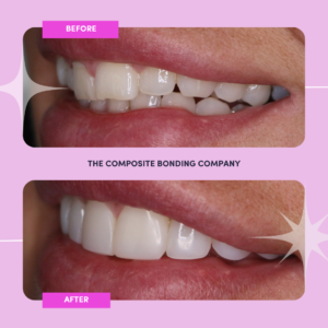N1 B&A