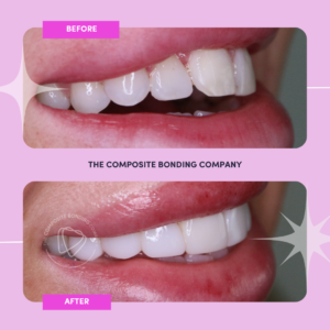 O1 B&A